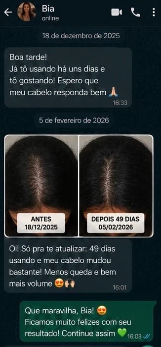 Bia · cliente SIS Beauty · 49 dias de uso
